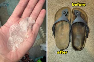 Close-up of a hand holding a used overnight nose acne patch and a reviewer "before" and "after" image showing a stained carpet and the same carpet cleaned